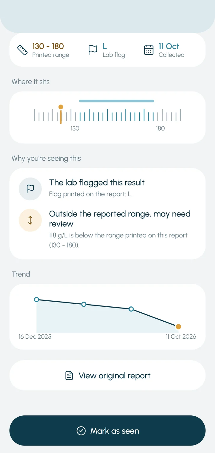 Alert detail: reasons, trend chart and Mark as seen